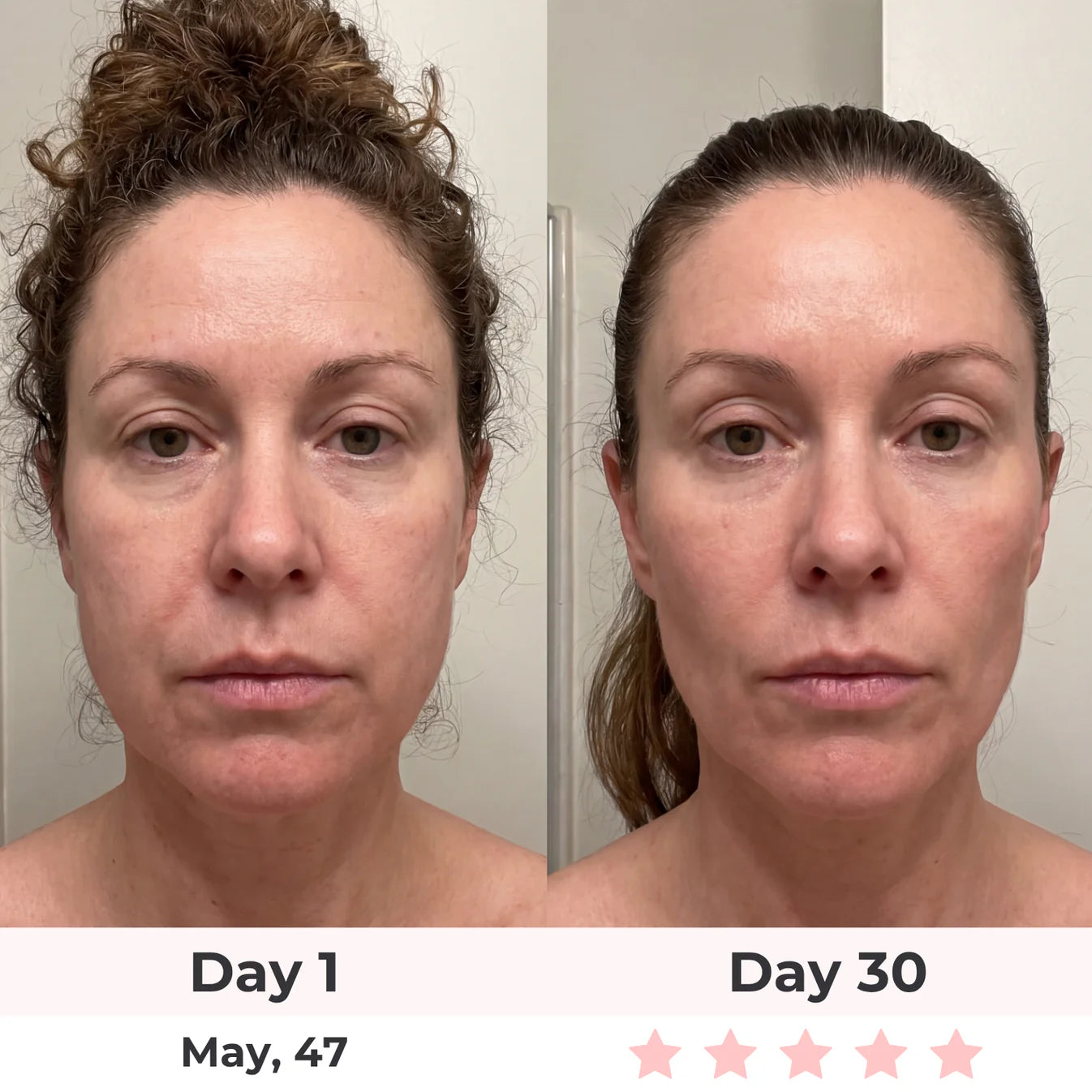 Lumatra 3-in-1 LED Facial Sculptor