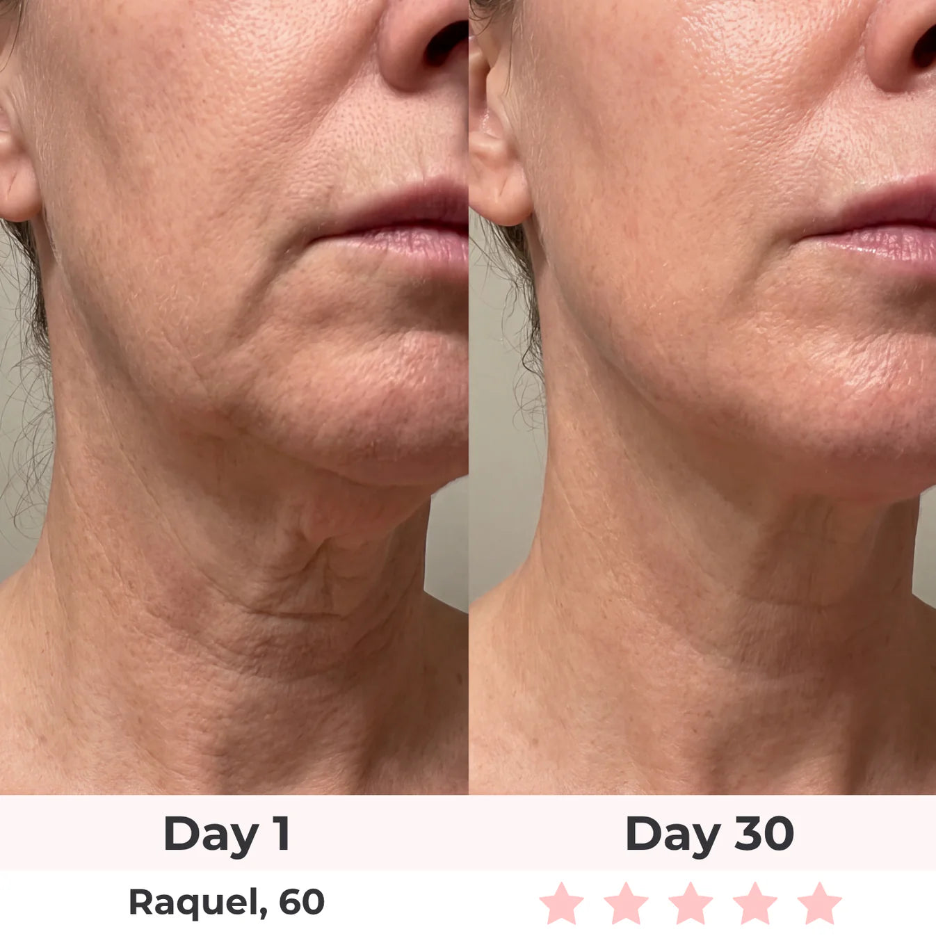 Lumatra 3-in-1 LED Facial Sculptor