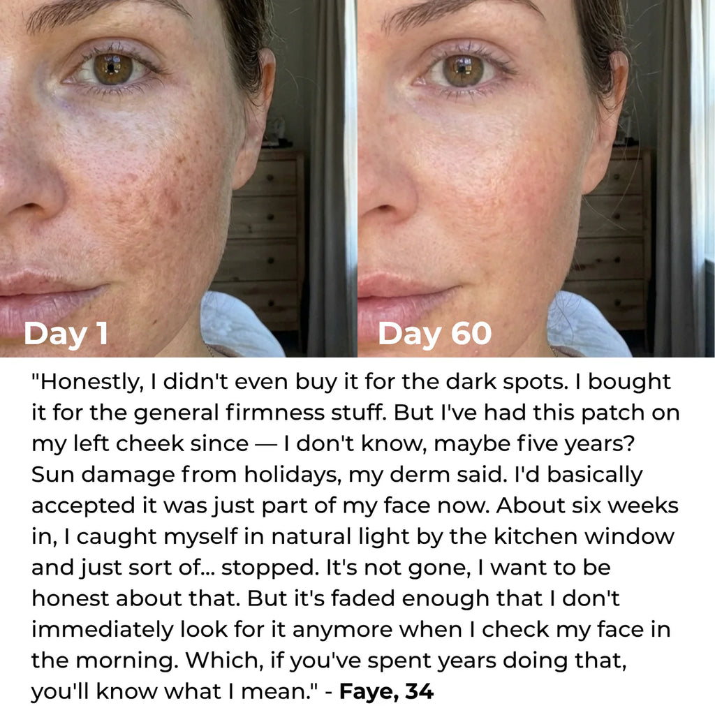 Lumatra 3-in-1 LED Facial Sculptor