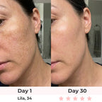 Lumatra 3-in-1 LED Facial Sculptor