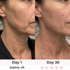 Lumatra 3-in-1 LED Facial Sculptor