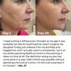Lumatra 3-in-1 LED Facial Sculptor