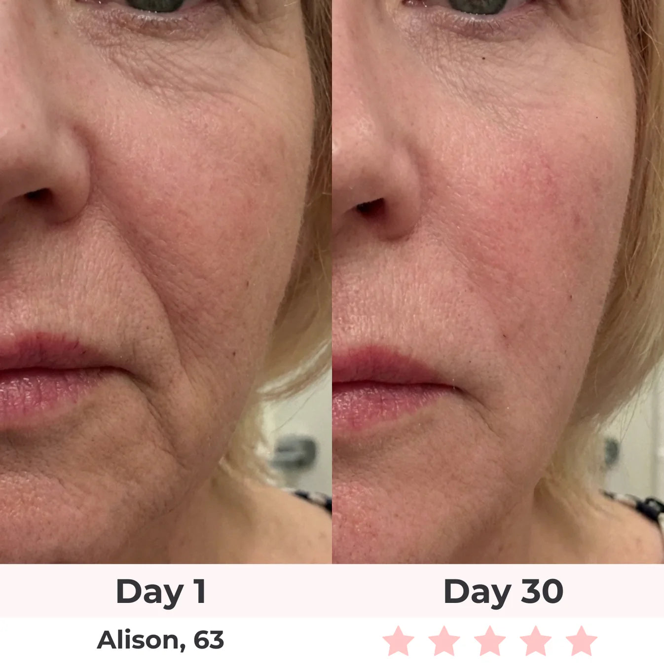 Lumatra 3-in-1 LED Facial Sculptor