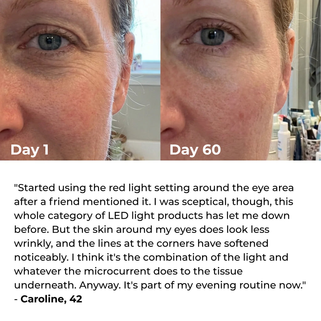 Lumatra 3-in-1 LED Facial Sculptor