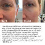 Lumatra 3-in-1 LED Facial Sculptor