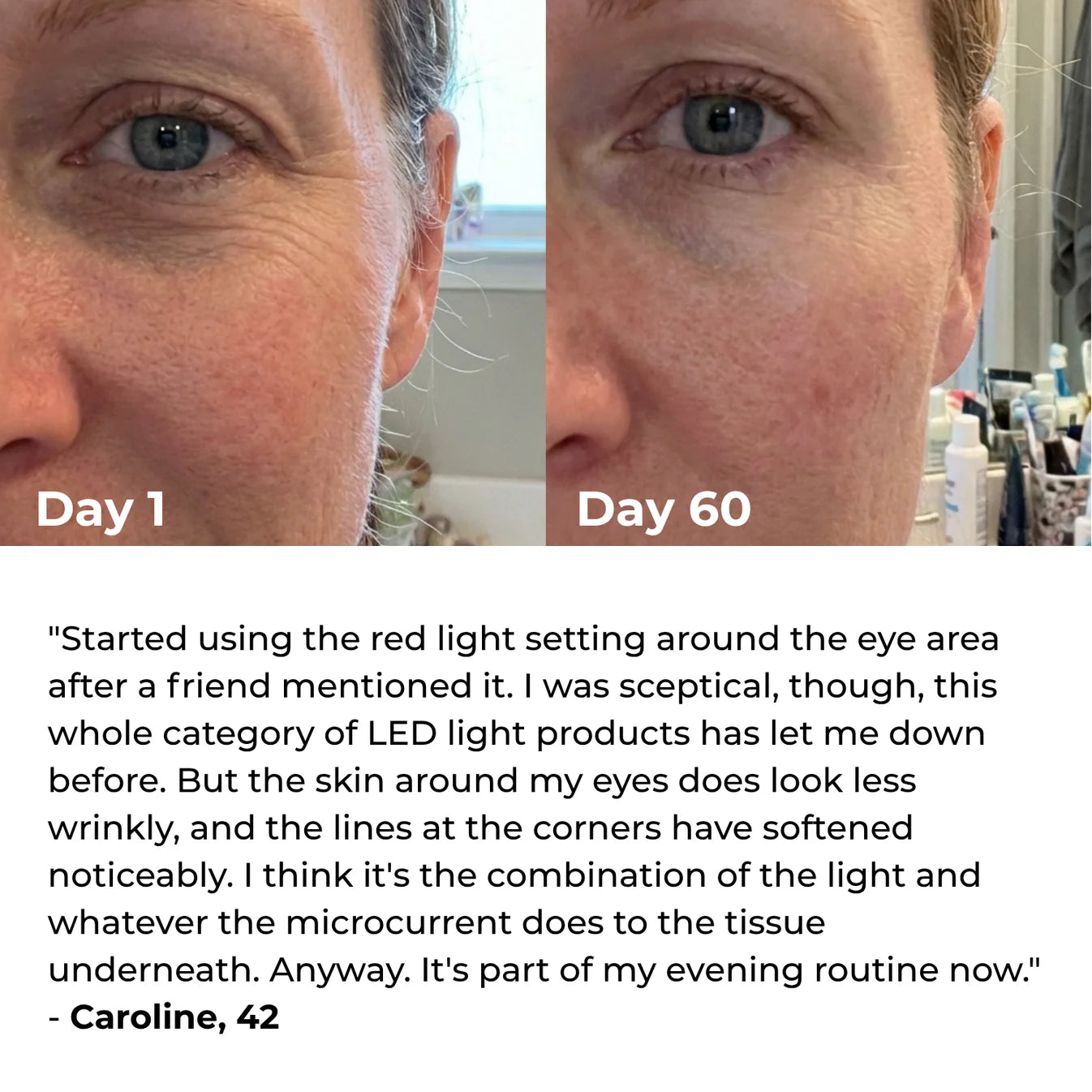 Lumatra 3-in-1 LED Facial Sculptor