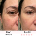 Lumatra 3-in-1 LED Facial Sculptor